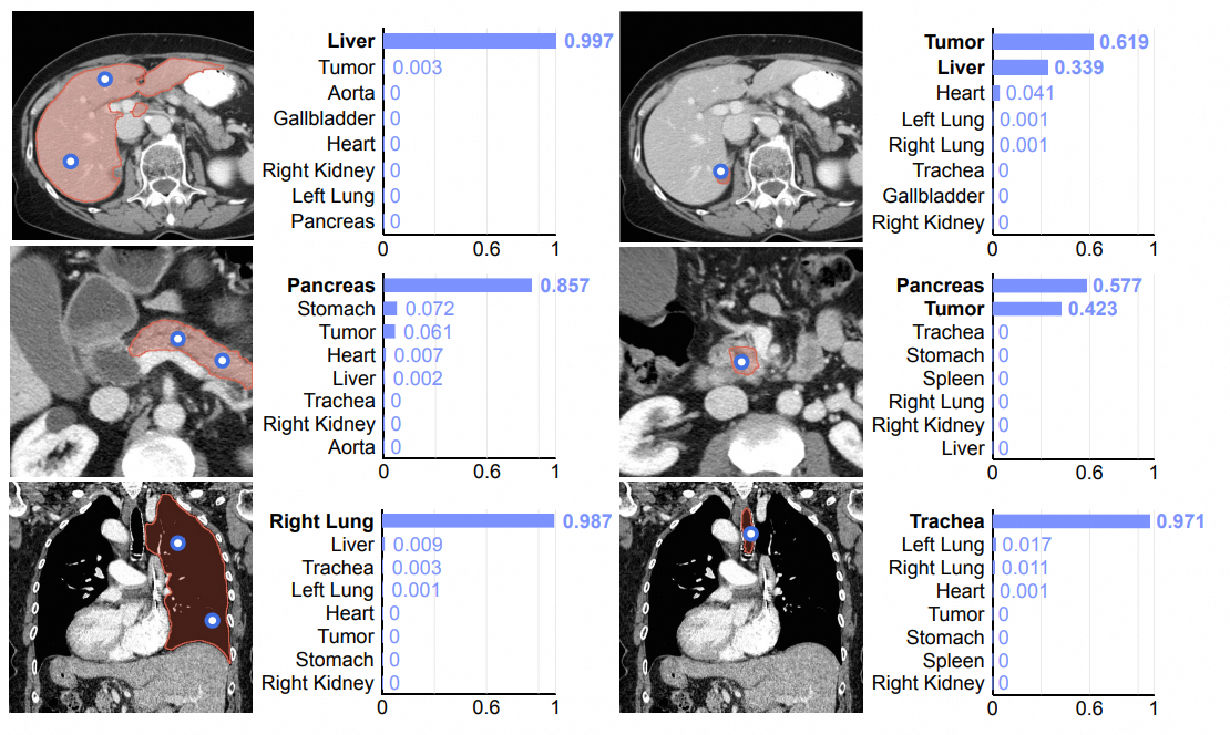 Representative figure for SegVol publication
